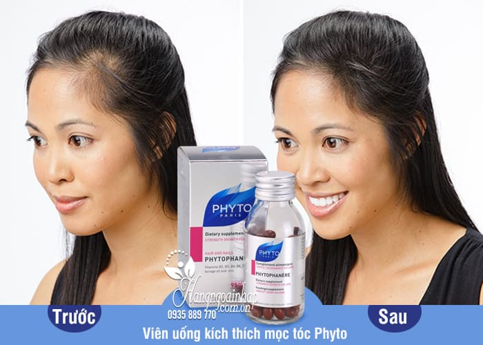 Đánh giá của khách hàng Viên uống hỗ trợ mọc tóc Phyto